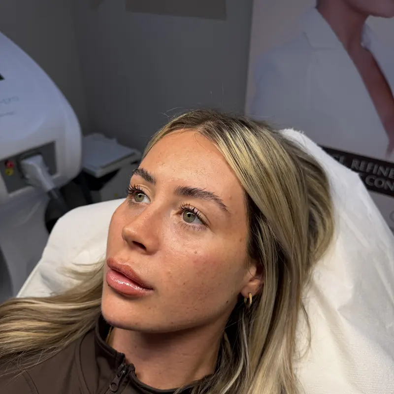 A client immediately after treatment in the Prestwich clinic